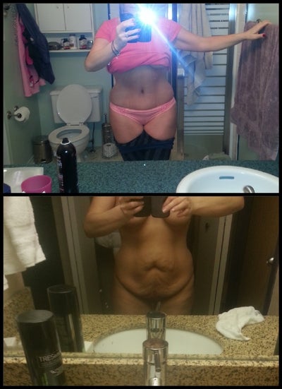 Hcg Before And After Pictures 2013