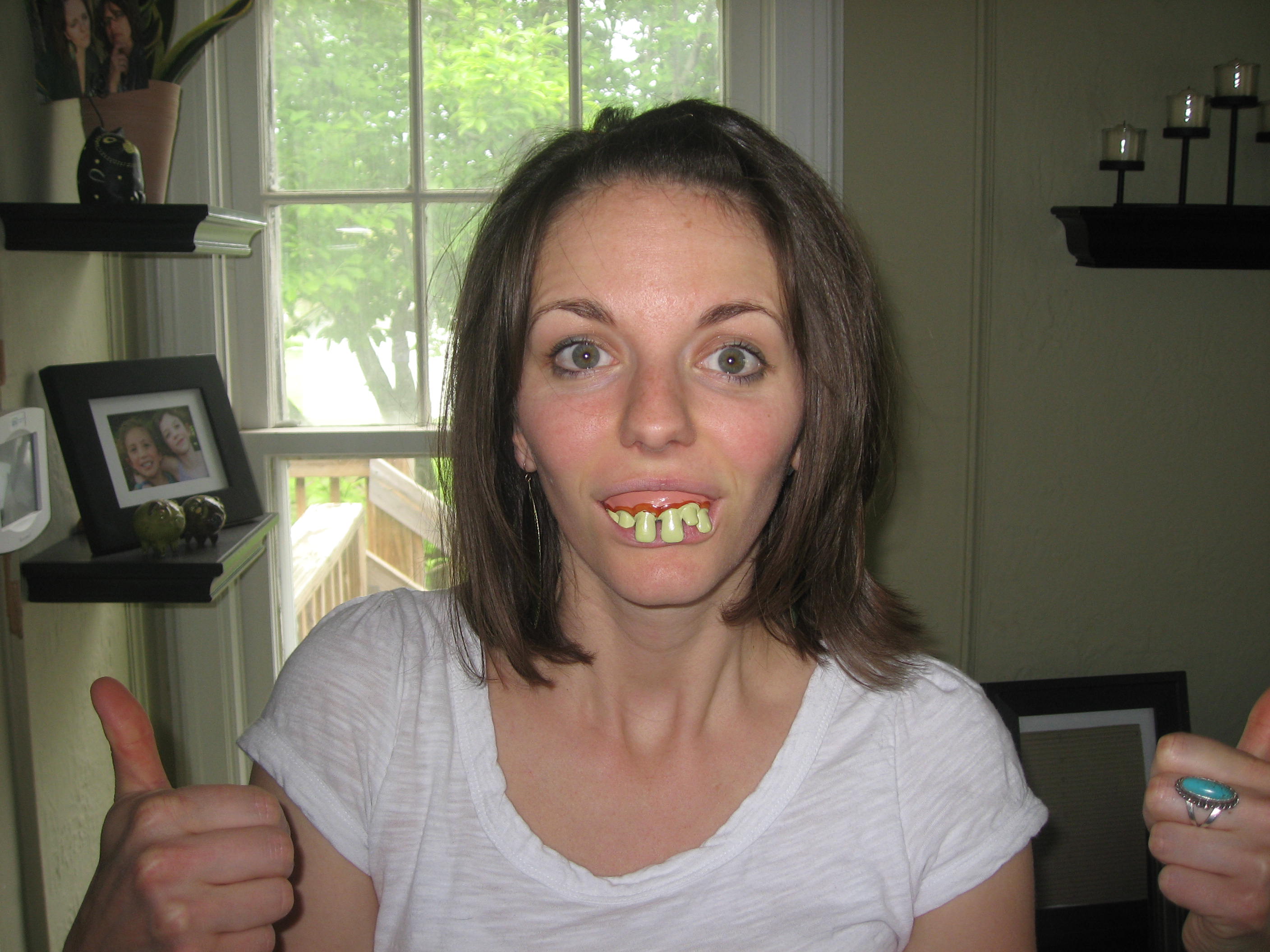 Hillbilly Teeth Pictures