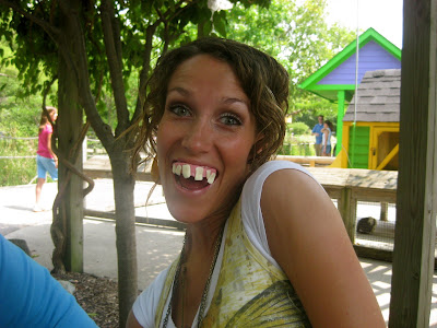 Hillbilly Teeth Pictures