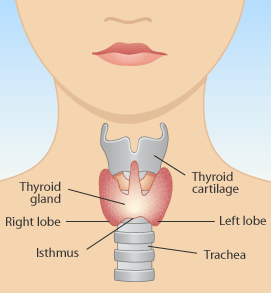 How To Shrink A Goiter On Thyroid