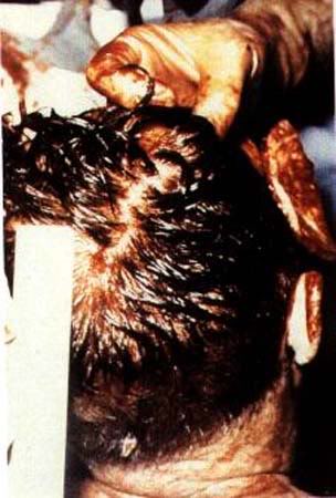 Jfk Assassination Photos Autopsy