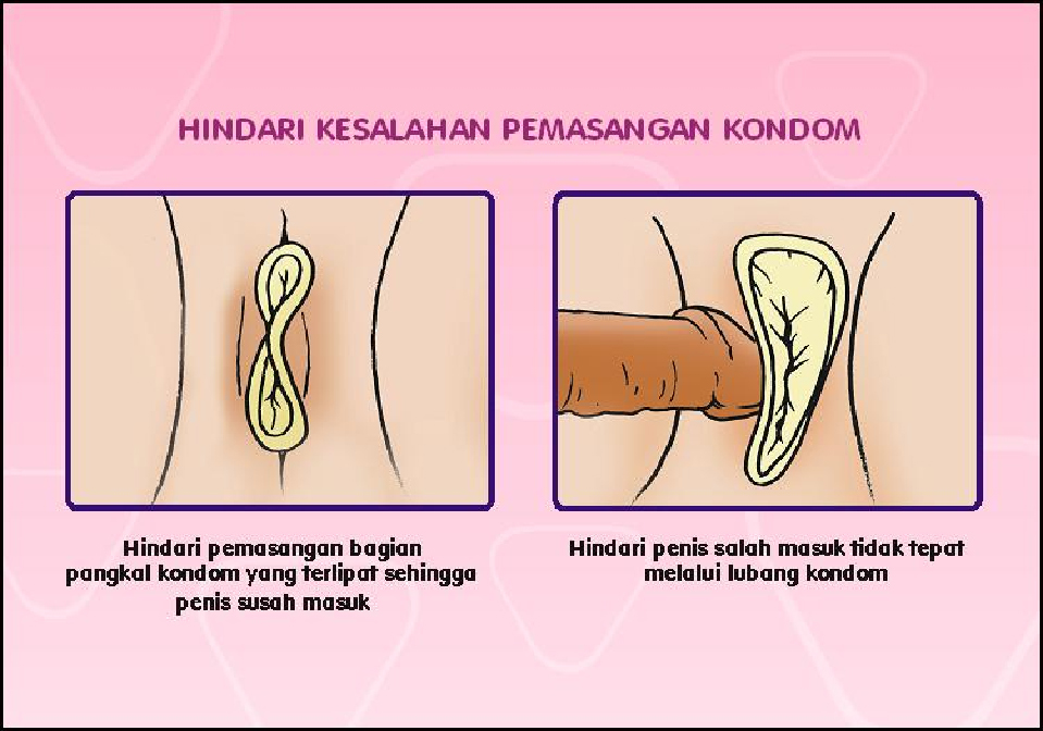 Kondom Perempuan