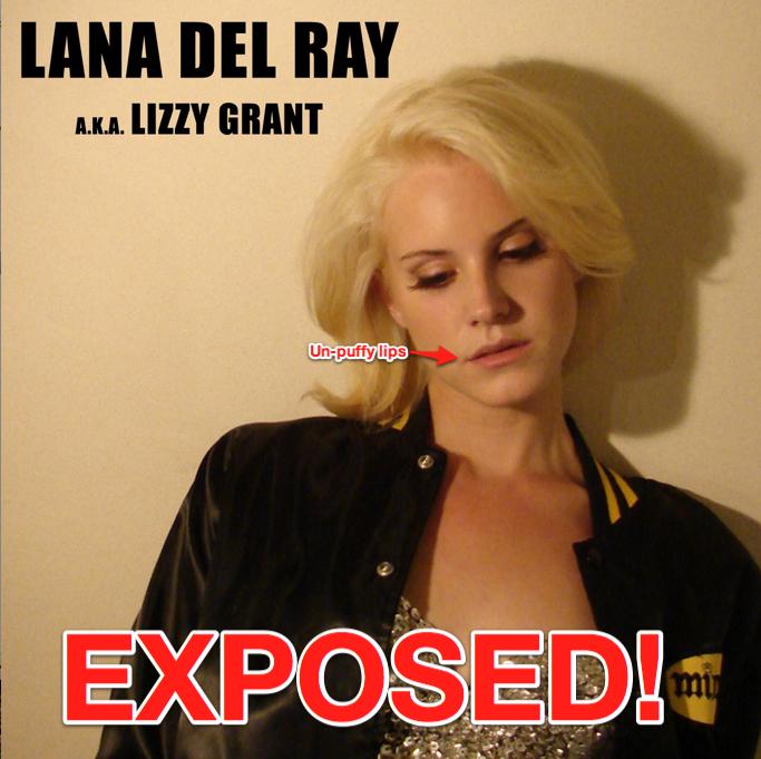 Lizzy Grant Lana Del Rey Before And After